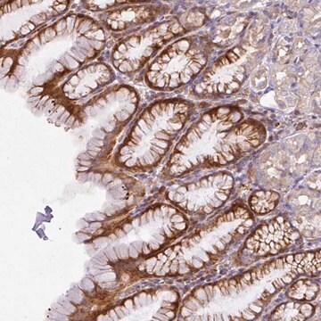 Anti-ATP6V1F antibody produced in rabbit Prestige Antibodies&#174; Powered by Atlas Antibodies, affinity isolated antibody, buffered aqueous glycerol solution