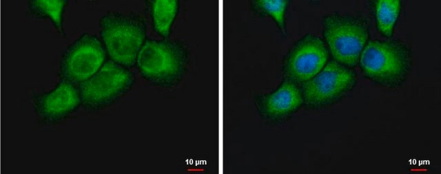 Anti-PLAUR antibody produced in rabbit affinity isolated antibody, buffered aqueous solution