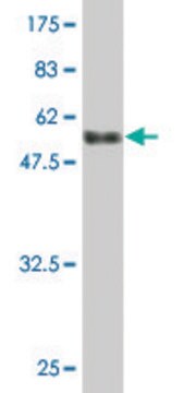 Monoclonal Anti-PMM2 antibody produced in mouse clone 2A5, purified immunoglobulin, buffered aqueous solution