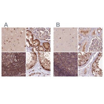 Anti-NSFL1C antibody produced in rabbit Prestige Antibodies&#174; Powered by Atlas Antibodies, affinity isolated antibody, buffered aqueous glycerol solution