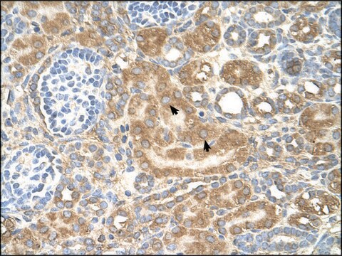 Anti-SPTLC1 antibody produced in rabbit affinity isolated antibody