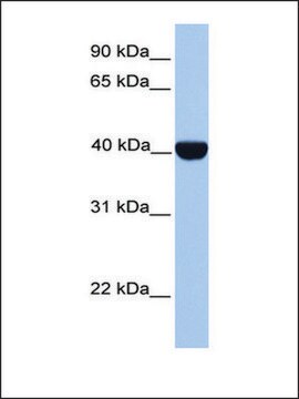 Anti-CSNK2A2 (AB1) antibody produced in rabbit affinity isolated antibody