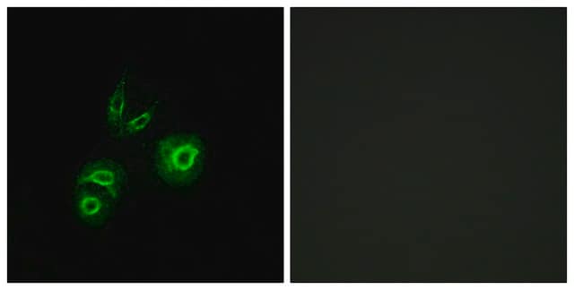 Anti-MET antibody produced in rabbit affinity isolated antibody