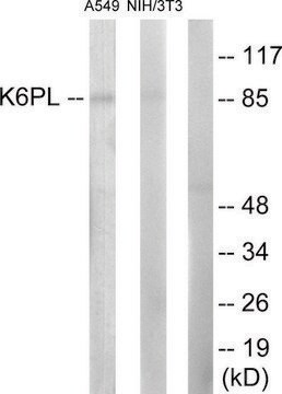 Anti-K6PL antibody produced in rabbit affinity isolated antibody