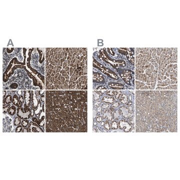 Anti-ETFA antibody produced in rabbit Prestige Antibodies&#174; Powered by Atlas Antibodies, affinity isolated antibody, buffered aqueous glycerol solution