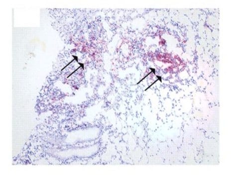 Anticuerpo anti-S100A12 Chemicon&#174;, from rabbit