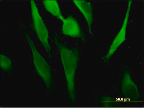 Monoclonal Anti-RSAD2, (C-terminal) antibody produced in mouse clone 4D10, purified immunoglobulin, buffered aqueous solution