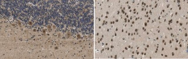 Anti-Mediator complex subunit 25 from rabbit, purified by affinity chromatography