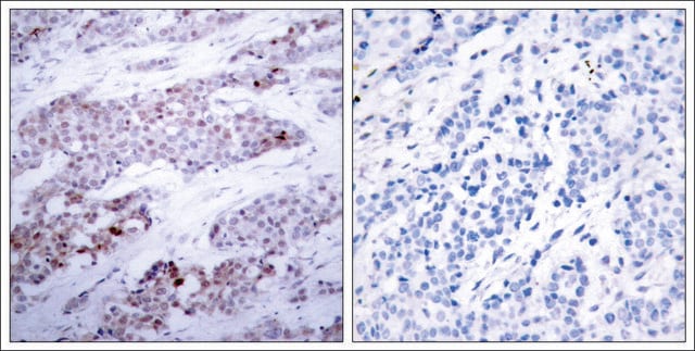 Anti-phospho-ATF4 (pSer245) antibody produced in rabbit affinity isolated antibody