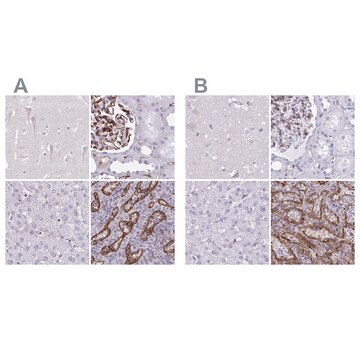 Anti-PITPNM3 antibody produced in rabbit Prestige Antibodies&#174; Powered by Atlas Antibodies, affinity isolated antibody, buffered aqueous glycerol solution