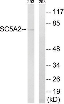 Anti-SLC5A2 antibody produced in rabbit affinity isolated antibody