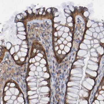 Anti-LMBRD2 antibody produced in rabbit Prestige Antibodies&#174; Powered by Atlas Antibodies, affinity isolated antibody, buffered aqueous glycerol solution