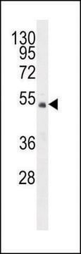 ANTI-FAM102A (C-TERM) antibody produced in rabbit IgG fraction of antiserum, buffered aqueous solution