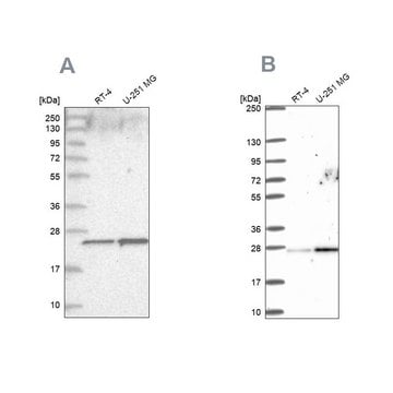 Anti-NOP16 antibody produced in rabbit Prestige Antibodies&#174; Powered by Atlas Antibodies, affinity isolated antibody, buffered aqueous glycerol solution