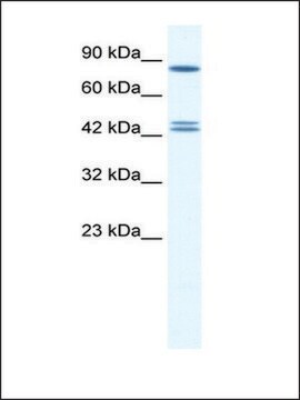 Anti-CBX8 (AB1) antibody produced in rabbit affinity isolated antibody