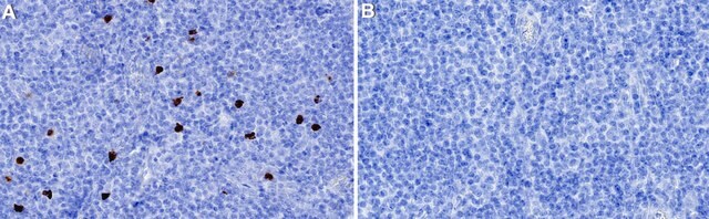 Anti-IL-5 Antibody, clone 1B20 ZooMAb&#174; Rabbit Monoclonal recombinant, expressed in HEK 293 cells