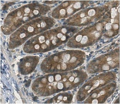 Anti-Peptide YY Antibody from chicken, purified by affinity chromatography