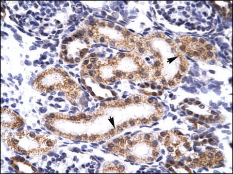 Anti-TRIM3 antibody produced in rabbit IgG fraction of antiserum