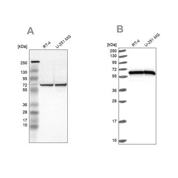 Anti-HSPD1 antibody produced in rabbit Prestige Antibodies&#174; Powered by Atlas Antibodies, affinity isolated antibody, buffered aqueous glycerol solution