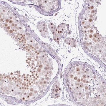 Anti-ELOA3 antibody produced in rabbit Prestige Antibodies&#174; Powered by Atlas Antibodies, affinity isolated antibody, buffered aqueous glycerol solution