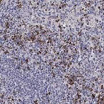 Anti-CHIT1 antibody produced in rabbit Prestige Antibodies&#174; Powered by Atlas Antibodies, affinity isolated antibody, buffered aqueous glycerol solution