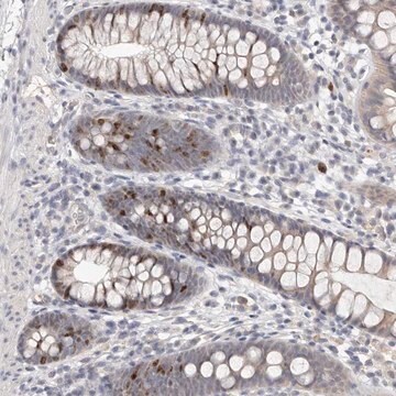 Anti-CCDC190 antibody produced in rabbit Prestige Antibodies&#174; Powered by Atlas Antibodies, affinity isolated antibody, buffered aqueous glycerol solution, ab3