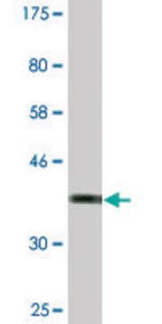 Monoclonal Anti-TOPORS antibody produced in mouse clone 5G9, ascites fluid, solution