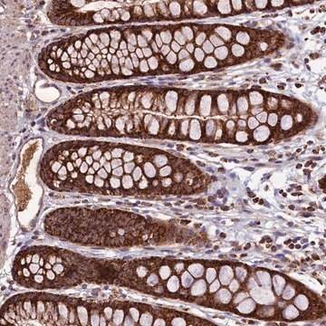 Anti-STARD5 antibody produced in rabbit Prestige Antibodies&#174; Powered by Atlas Antibodies, affinity isolated antibody, buffered aqueous glycerol solution