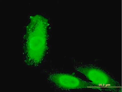 ANTI-IRAK3 antibody produced in mouse clone 1C8, purified immunoglobulin, buffered aqueous solution