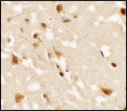 Anti-AIG1 antibody produced in rabbit affinity isolated antibody