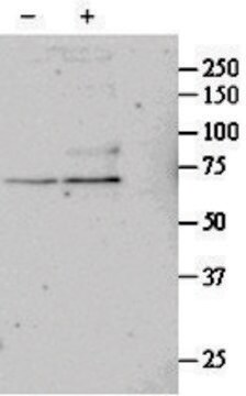 Anti-SRF antibody produced in goat affinity isolated antibody, buffered aqueous solution