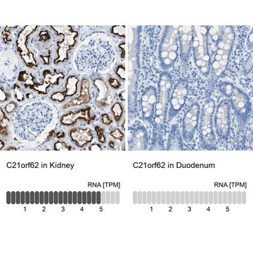 Anti-C21orf62 antibody produced in rabbit Prestige Antibodies&#174; Powered by Atlas Antibodies, affinity isolated antibody, buffered aqueous glycerol solution