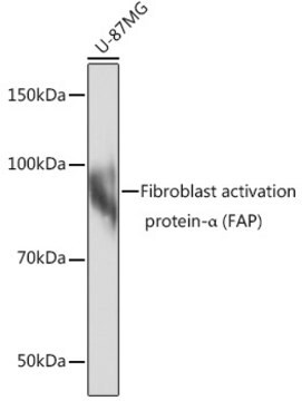 Anti-Fibroblast activation protein-&#945; (FAP) Antibody, clone 10A6P6, Rabbit Monoclonal