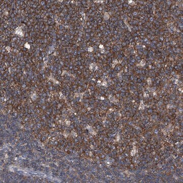 Anti-PIP5K1A antibody produced in rabbit Prestige Antibodies&#174; Powered by Atlas Antibodies, affinity isolated antibody, buffered aqueous glycerol solution