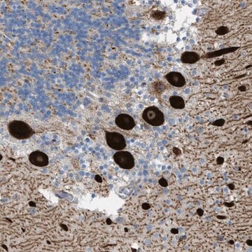 Anti-ATP2A3 antibody produced in rabbit Prestige Antibodies&#174; Powered by Atlas Antibodies, affinity isolated antibody, buffered aqueous glycerol solution