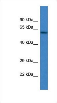 Anti-HPSE antibody produced in rabbit affinity isolated antibody