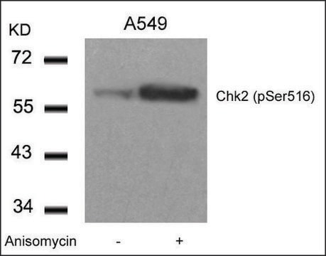 Anti-phospho-CHEK2 (pSer516) antibody produced in rabbit affinity isolated antibody