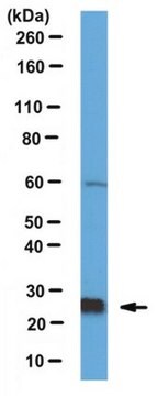 Anti-Rab21 Antibody from rabbit, purified by affinity chromatography