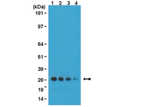 Anticorps anti-GFP, clone 3F8.2 clone 3F8.2, from mouse