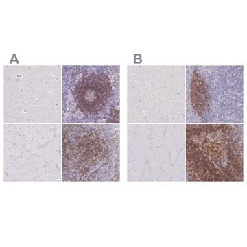 Anti-CD37 antibody produced in rabbit Prestige Antibodies&#174; Powered by Atlas Antibodies, affinity isolated antibody, buffered aqueous glycerol solution