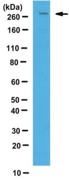 Anti-LRRK2 Antibody from rabbit, purified by affinity chromatography