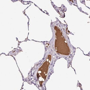 Anti-IGFL1 antibody produced in rabbit Prestige Antibodies&#174; Powered by Atlas Antibodies, affinity isolated antibody, buffered aqueous glycerol solution