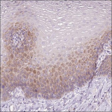 Anti-RSPO2 antibody produced in rabbit Prestige Antibodies&#174; Powered by Atlas Antibodies, affinity isolated antibody, buffered aqueous glycerol solution