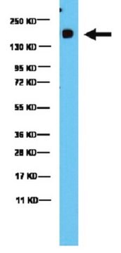 Przeciwciało anty-ROCK-1/2 from rabbit, purified by affinity chromatography