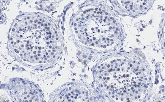 Anti-PIAS Antibody, clone 1O17 ZooMAb&#174; Rabbit Monoclonal recombinant, expressed in HEK 293 cells