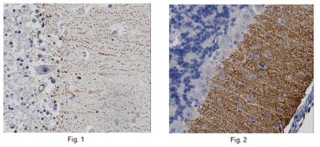 Anti-DGL-&#945; Antibody from rabbit, purified by affinity chromatography