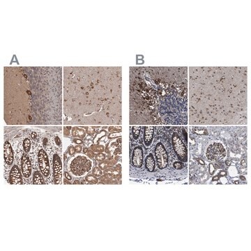 Anti-DARS antibody produced in rabbit Prestige Antibodies&#174; Powered by Atlas Antibodies, affinity isolated antibody, buffered aqueous glycerol solution, ab1