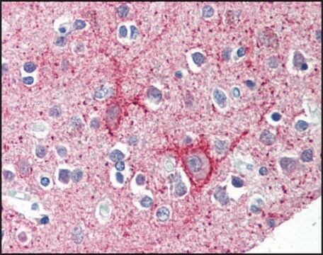 Anti-C12orf5 antibody produced in rabbit affinity isolated antibody, buffered aqueous solution