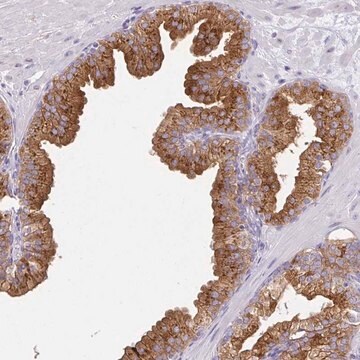 Anti-FAM177A1 antibody produced in rabbit Prestige Antibodies&#174; Powered by Atlas Antibodies, affinity isolated antibody, buffered aqueous glycerol solution