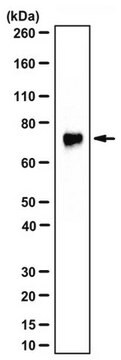 Anti-PRMT7 Antibody from rabbit, purified by affinity chromatography